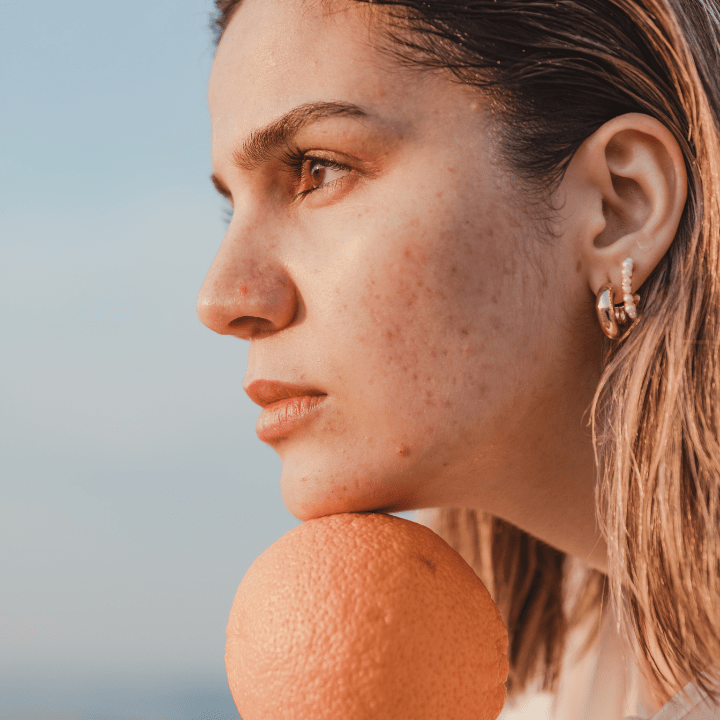 Soin visage Détox reims, soin anti-imperfections, nettoyage de peau